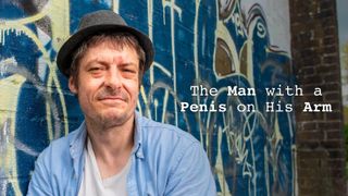 The Man with a Penis on His Arm