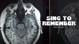 Sing to Remember: Defying Dementia
