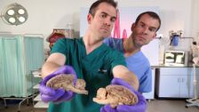 S6 E7: Mind-boggling Brains